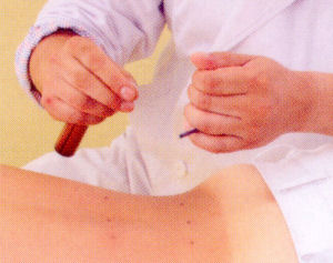 深谷灸シリーズ