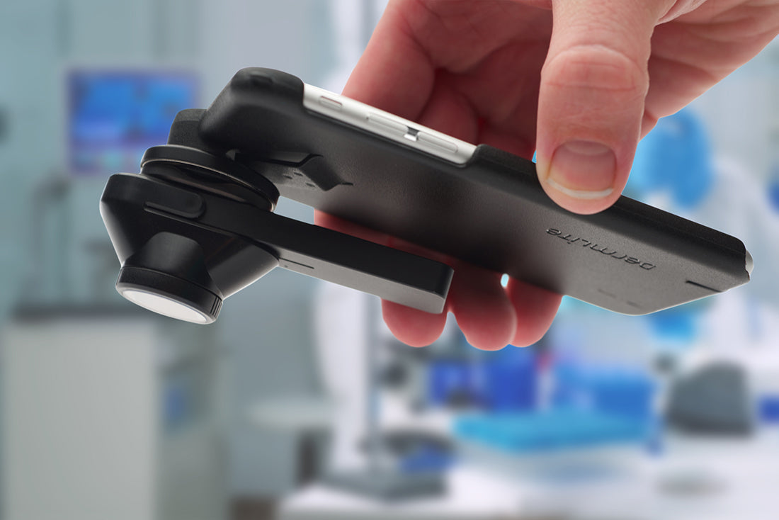 DermLite DL1 basic | Dermatoscopes.com