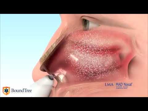 MAD Nasal™ Intranasal Mucosal Atomization Devices | Bound Tree