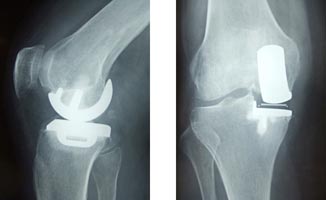 福岡みらい病院