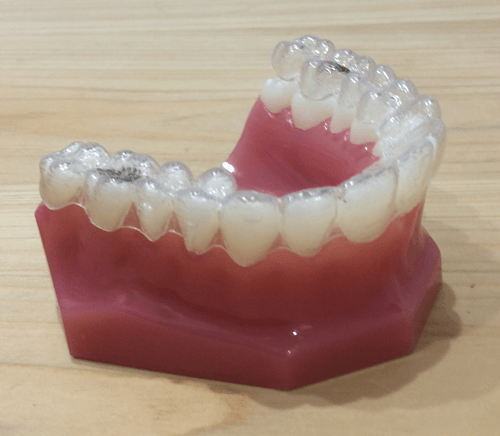 インビザライン取扱説明書｜【公式】池袋駅徒歩1分の矯正歯科・信頼の