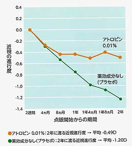 目に関するあれこれ：近視の進行を抑える目薬「マイオピン」をご存知