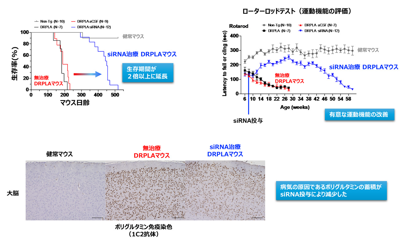 神経難病学 - 信州大学医学部医学科内科学第三教室