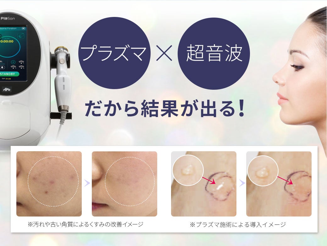 美容鍼灸×プラズマ美顔器プラソン | セブンビューティー