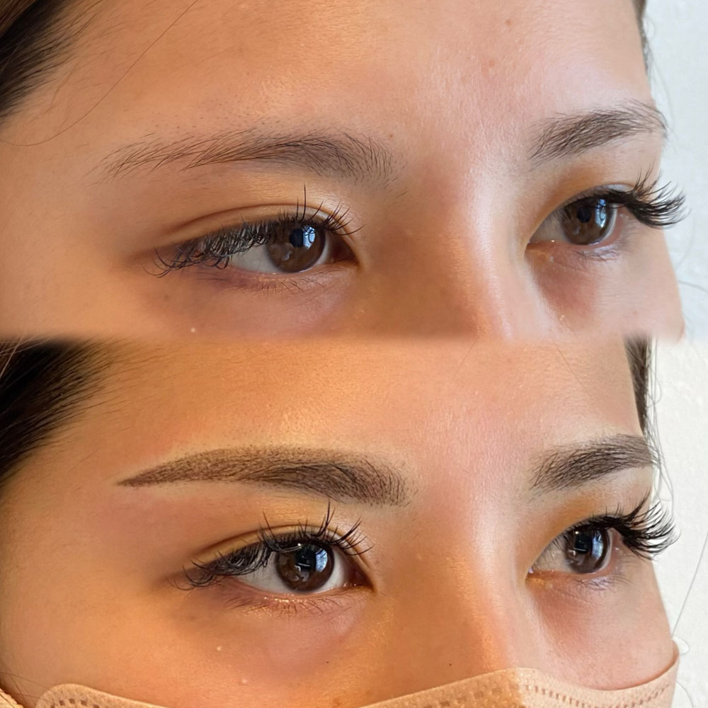 ザ・ナイン・メディカルアートメイク | The9 medical artmake【公式】