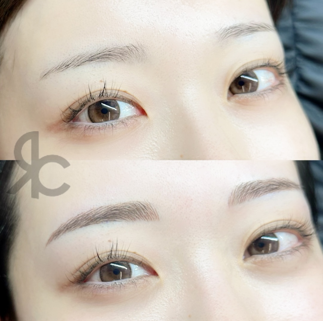 アートメイク | 六本木・恵比寿のTHE ROPPONGI CLINIC