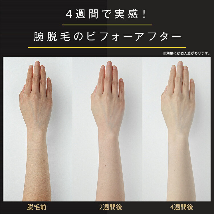 楽天市場】脱毛器 JOVS Dora2 SRモード A366 世界3冠 シリーズ265万台