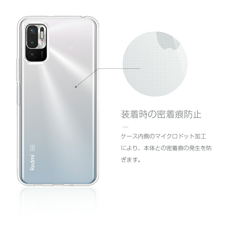楽天市場】Redmi Note 10 JE XIG02 / Redmi Note 10T スマホケース