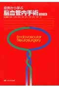楽天ブックス: 完全版 脳血管内治療学 - 病態・治療法の本質的理解と
