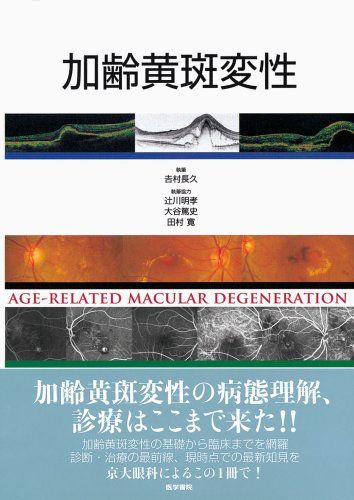 楽天市場】加齢黄斑変性 診療20のコツの通販