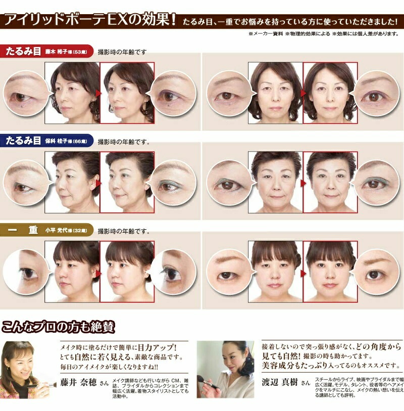 eyelidbeaute_ex06-a.jpg