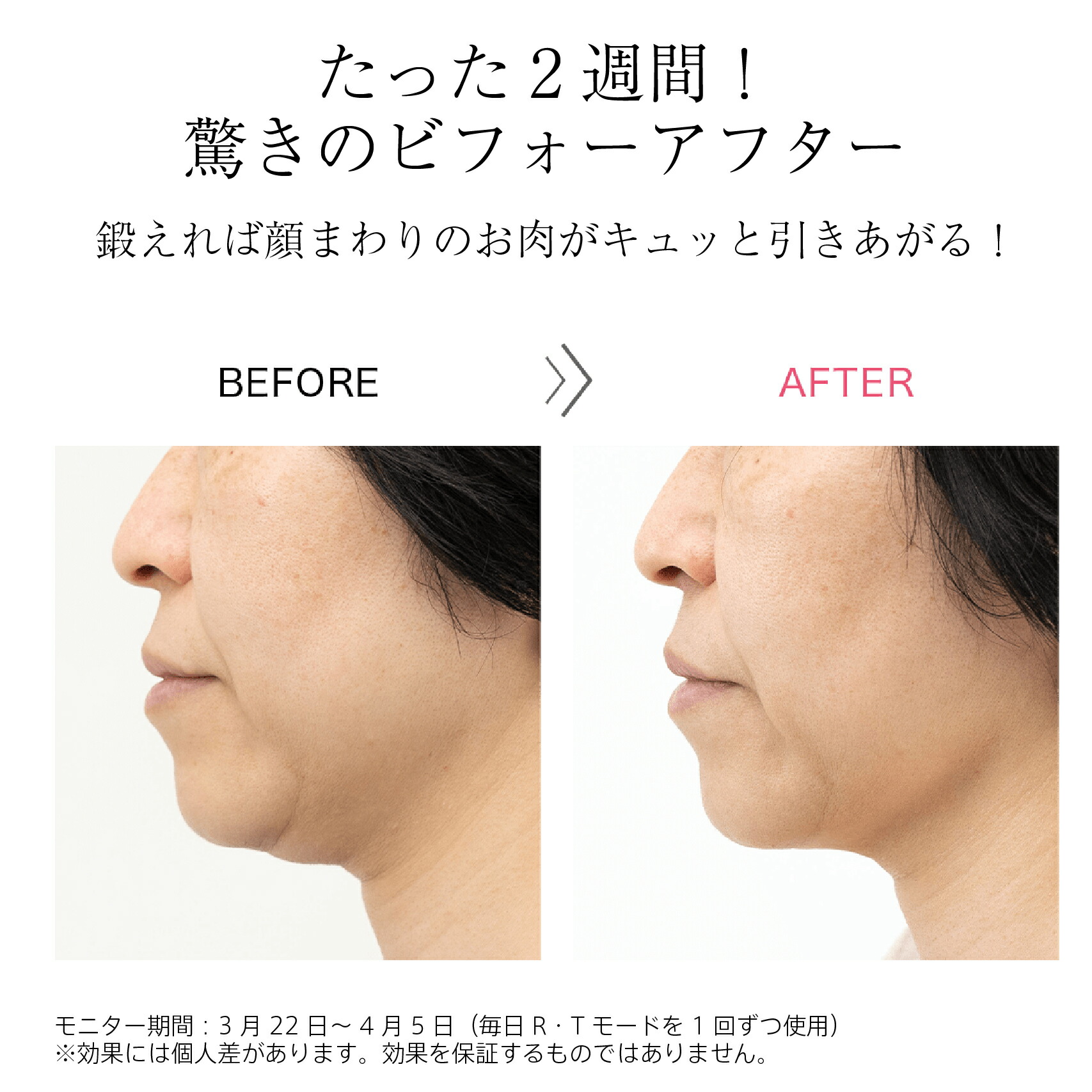 楽天市場】【メーカー直販】リフトレ/Liftre/ドクターエルミス/《送料