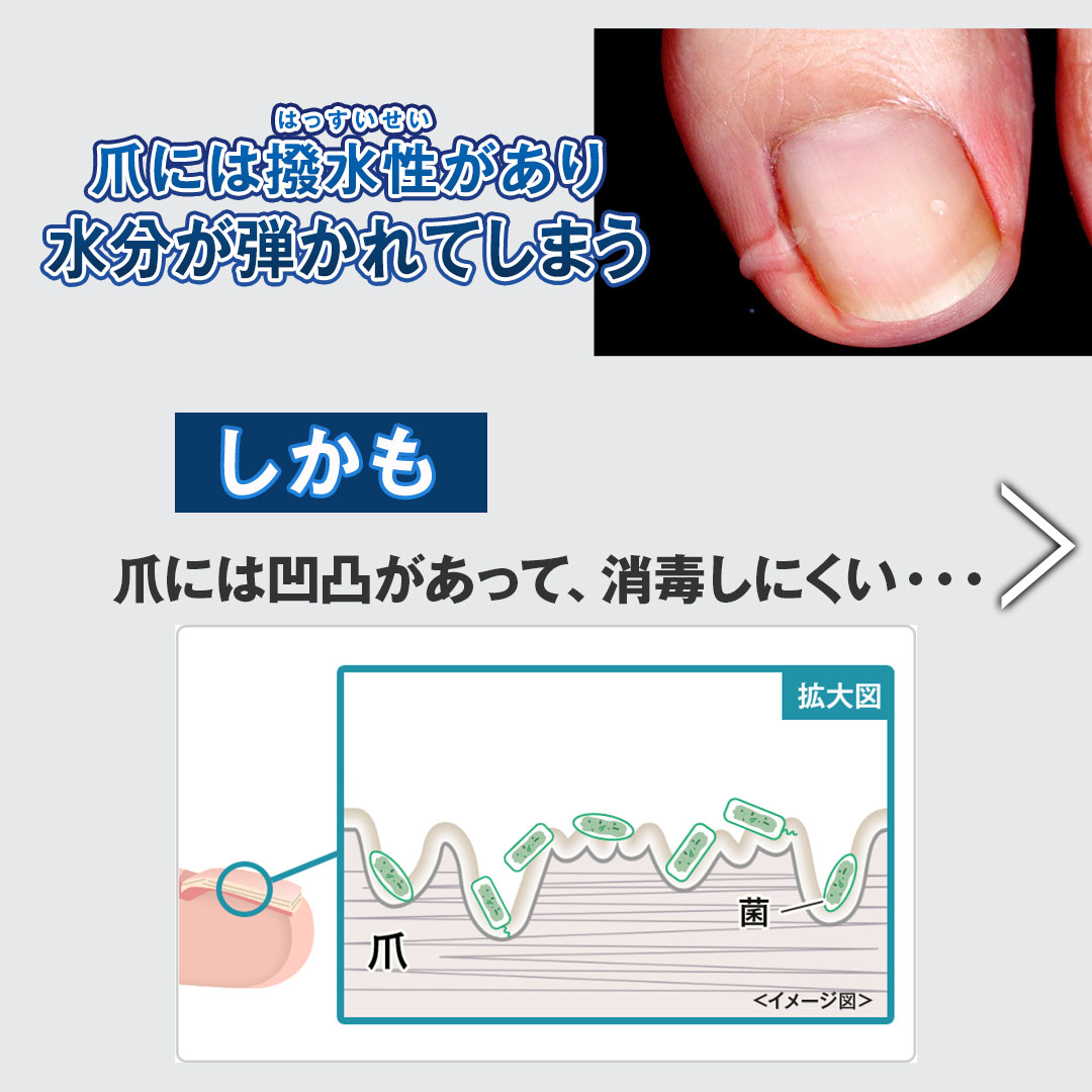 楽天市場】【10%OFFクーポン配布中】☆2個セットでお得！[爪周り 薬用