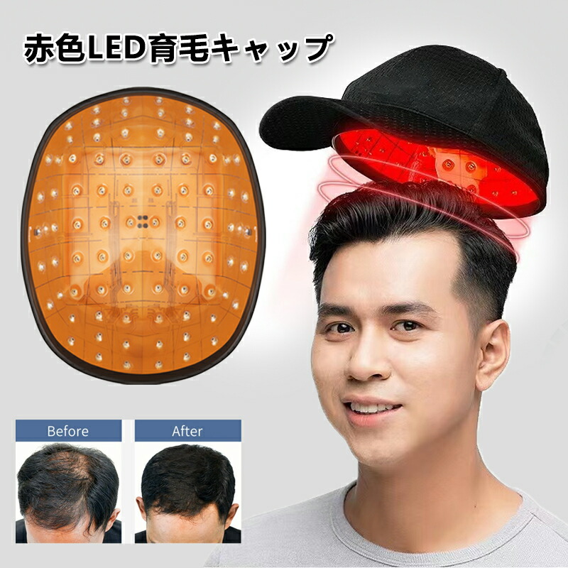 楽天市場】【即納】育毛キャップ 育毛システム81個 赤色 led 育毛
