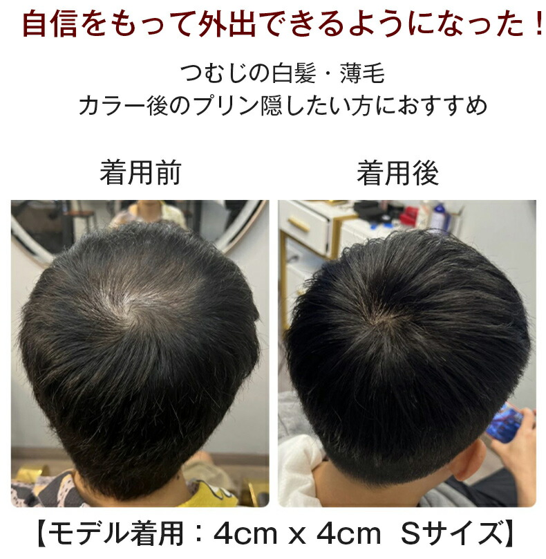 楽天市場】【試着可能 返品OK】 部分 ウィッグ 人毛 100% 頭頂部