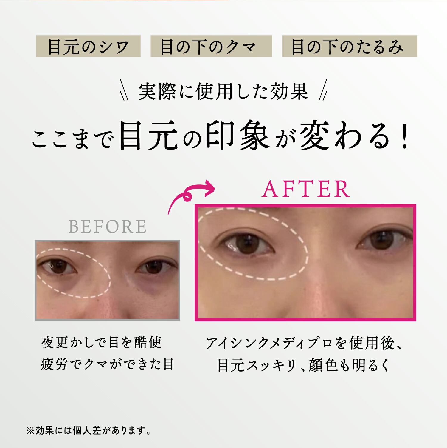 楽天市場】公式 スーパーSALE40%OFF 【 KYOGOKU アイシンク メディプロ