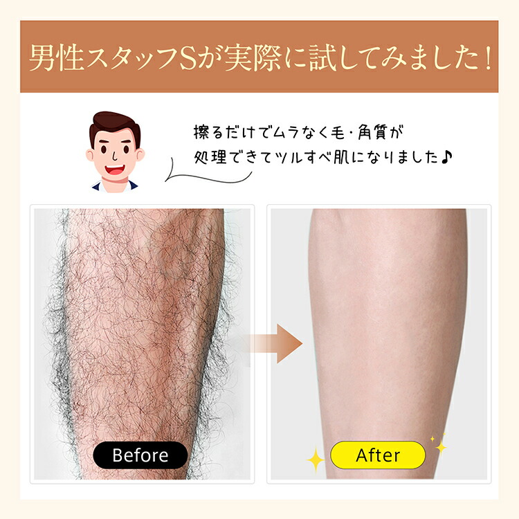 楽天市場】【高評価☆&ランキング1位獲得】こするだけ！ガラス脱毛器