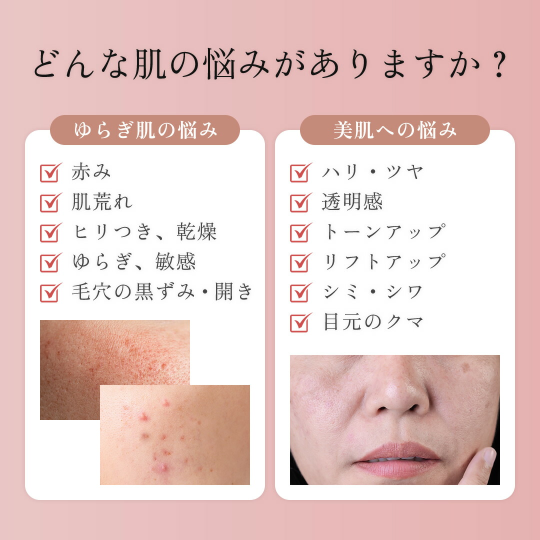 楽天市場】【10％OFF＆PT20倍！】可変式RF×可変式EMS×3色LED 美顔器