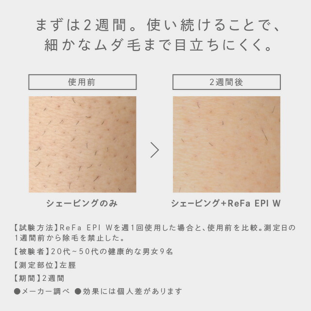 楽天市場】リファ エピ ダブル ReFa EPI W RE-AY-02A 最高峰 レベル