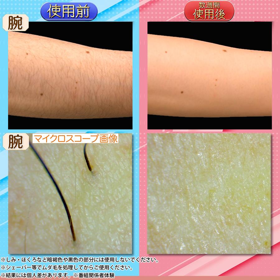 楽天市場】リファ エピ ゴー（ReFa EPI GO） ／ MTG RE-AR-02A