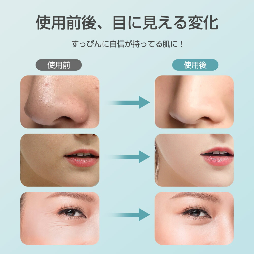 楽天市場】【楽天1位】 美顔器 超音波美顔器 全身防水 顔 ケア 超音波