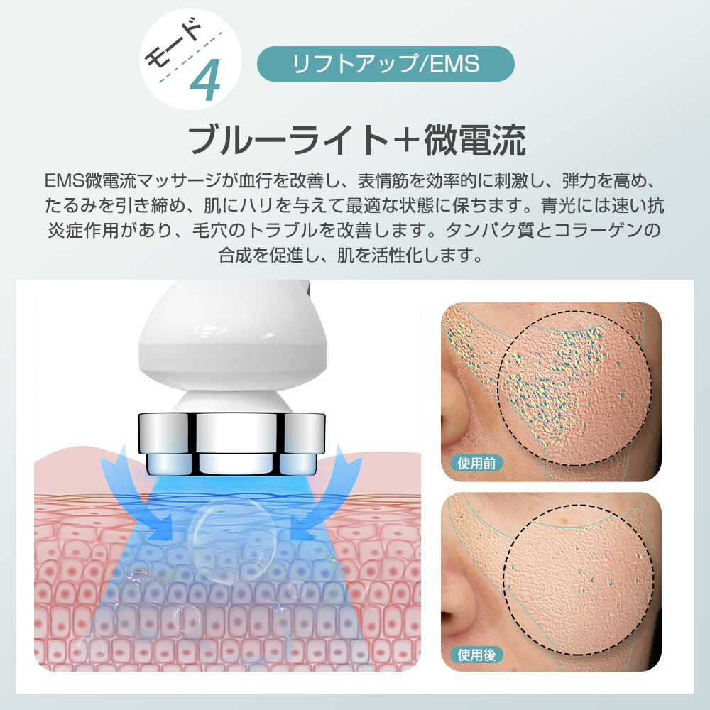 楽天市場】楽天1位 美顔器 超音波美顔器 イオン導入 イオン導出 温冷