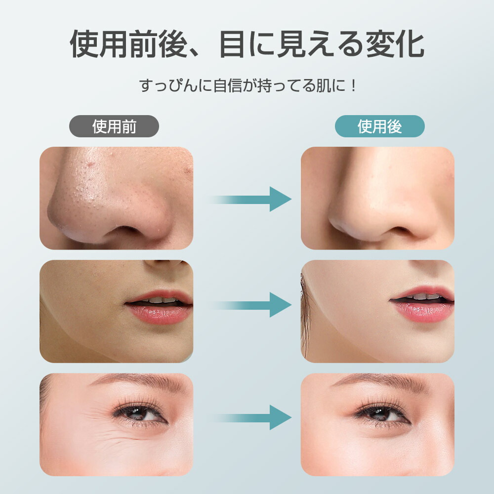 楽天市場】楽天1位 美顔器 超音波美顔器 イオン導入 イオン導出 温冷