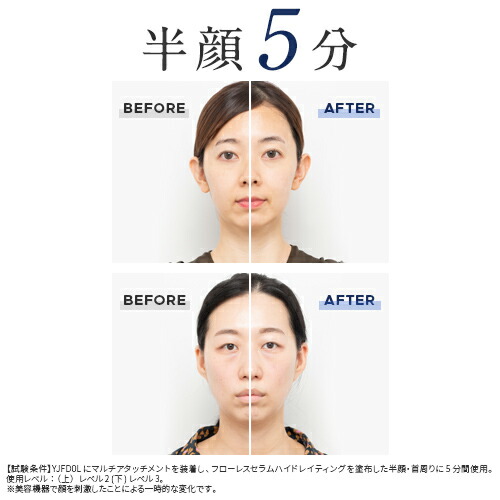 楽天市場】ブラシ 美顔器 《ハイパーフェイスリフトブラシ YJFD0L