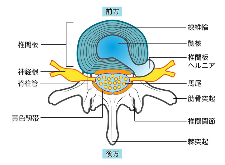 町田市 脊椎・脊髄疾患｜鶴川脳神経クリニック｜頸椎椎間板ヘルニア