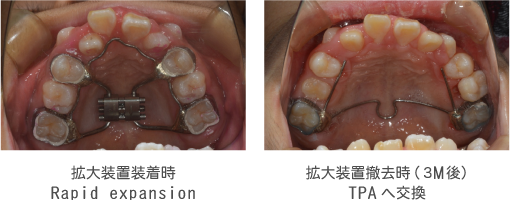 しまざき矯正歯科｜装置及び治療例