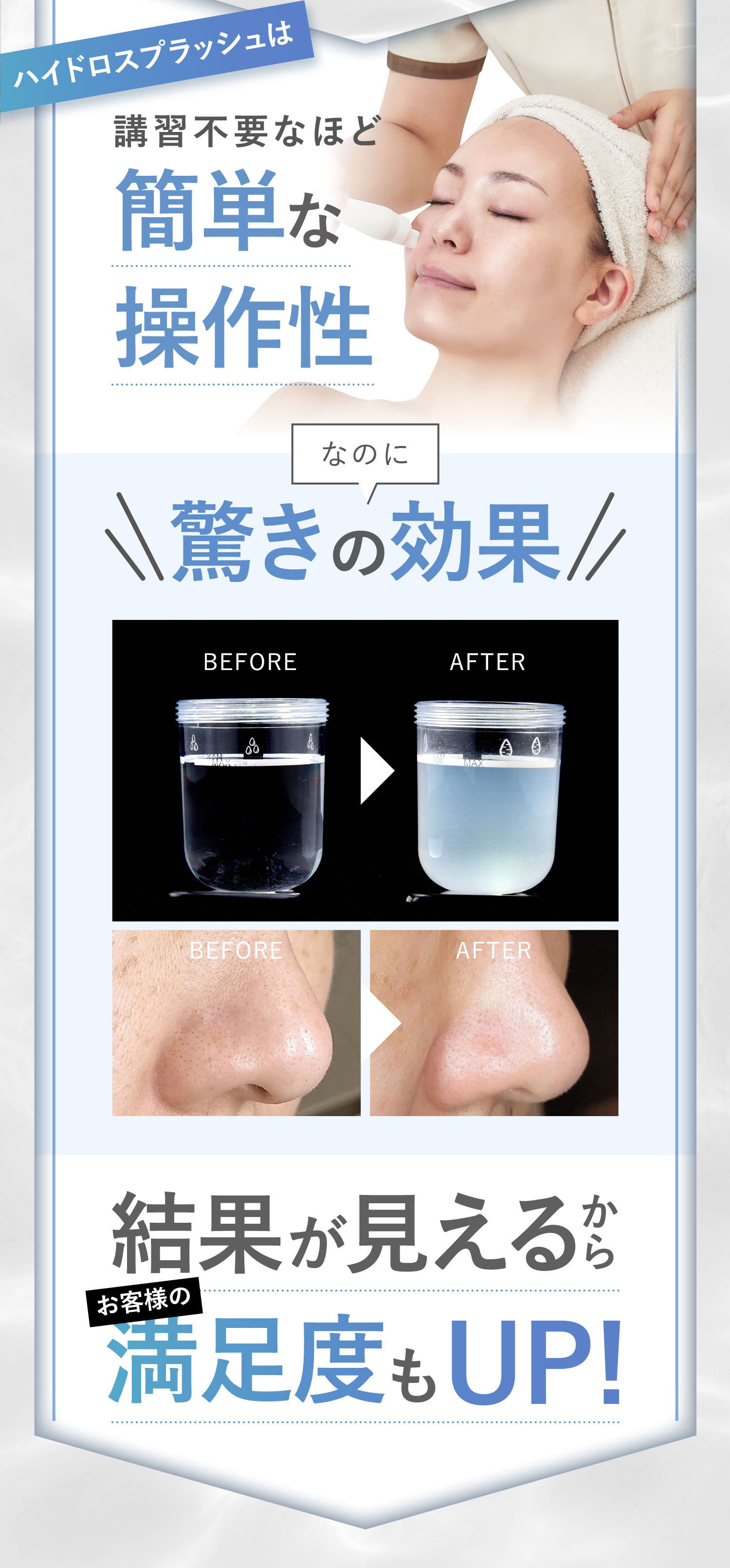 MISIRELTO ハイドロスプラッシュ