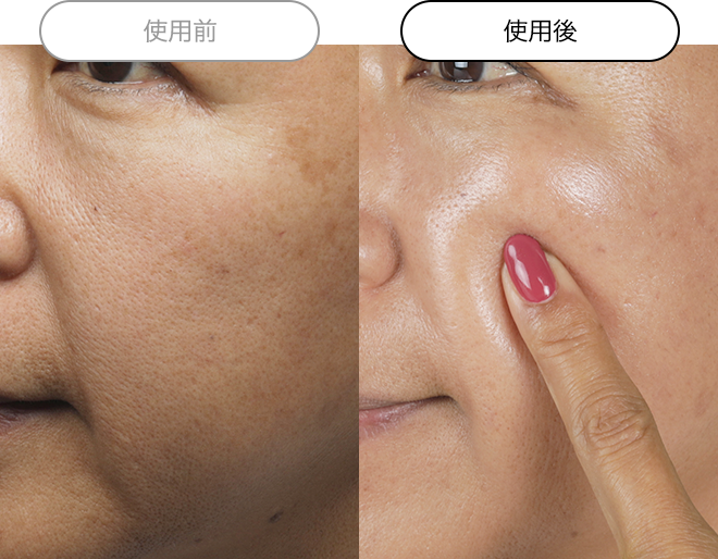 クエスク メディックス EXシリーズ | スキンケア化粧品・サイエンス