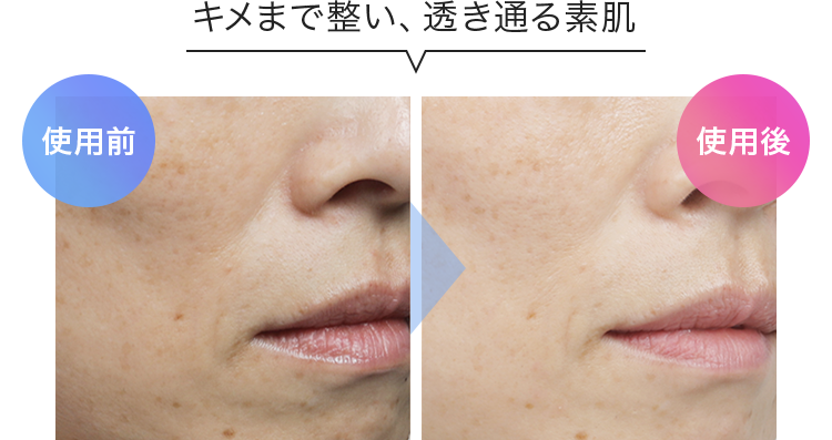 QuSomeホワイト2.0 スペシャルページ | スキンケア化粧品・サイエンス