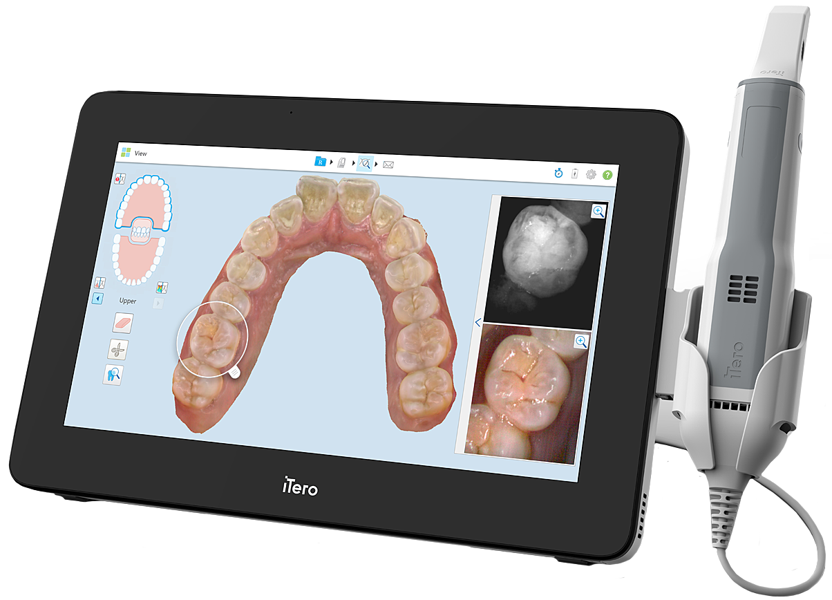 Expand your possibilities – iTero エレメント5Dプラスで広がる可能性