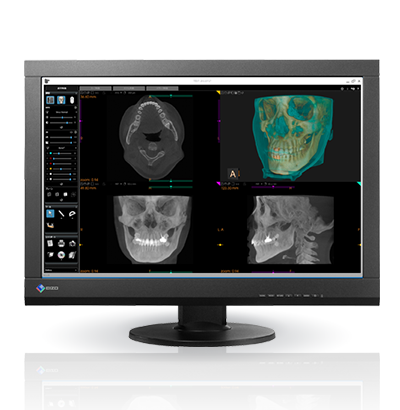 RadiForce MX242W 2.3MP Widescreen Monitor with DICOM | EIZO