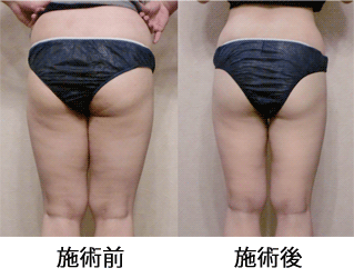 送料無料のノンFエナジークリームの激安通販