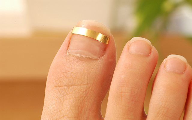 巻き爪補正コース プロ養成コース｜一般社団法人日本フットケア