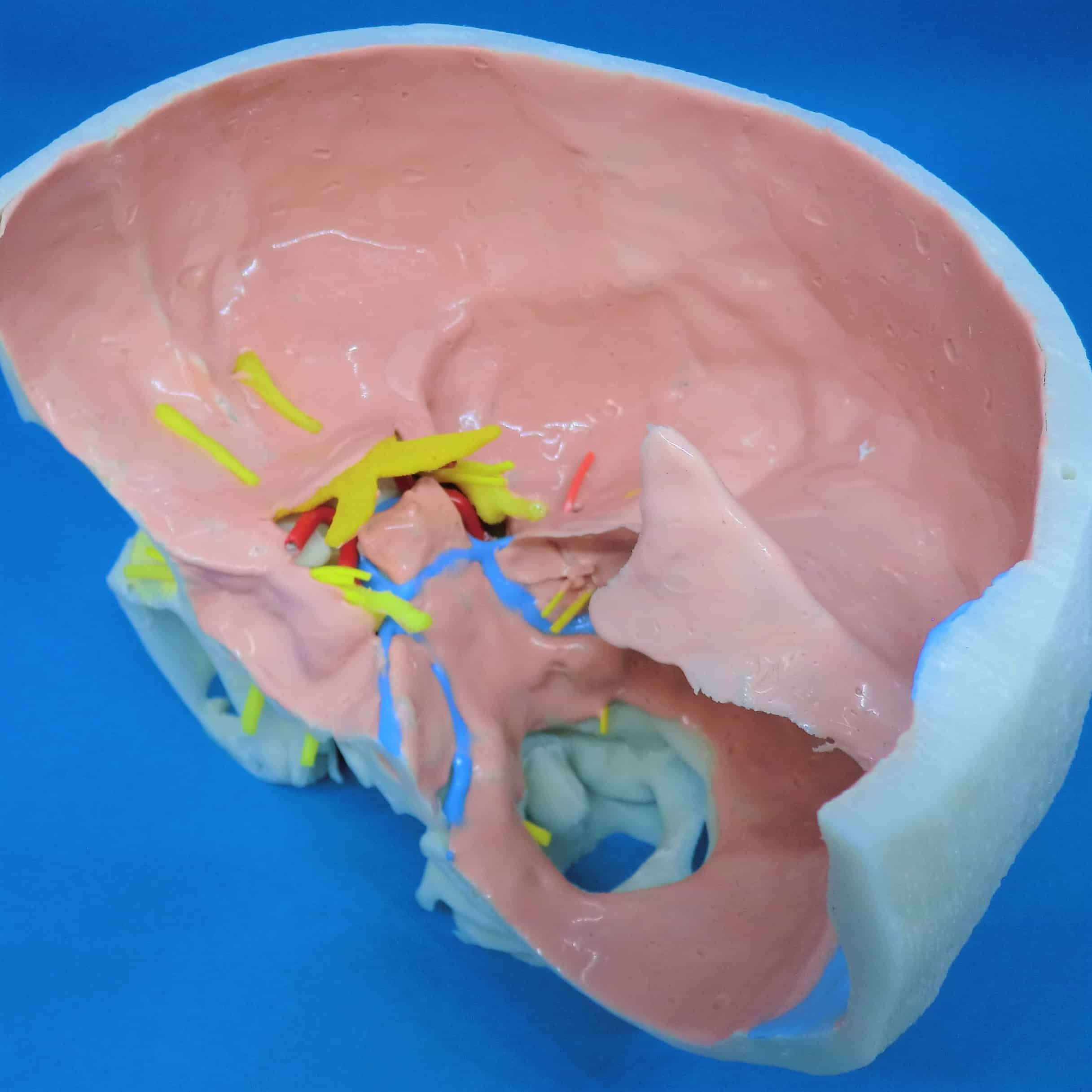 頭蓋底右側+硬膜+血管+神経（小脳テント付） A24-3の医療模型 | 3D