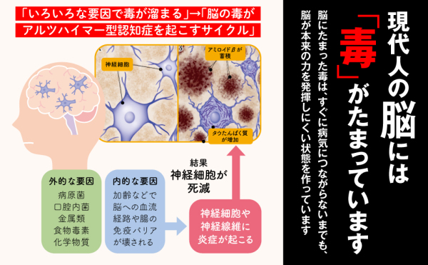 脳の毒を出す食品図鑑 / 白澤 卓二【著】/金丸 絵里加【栄養監修