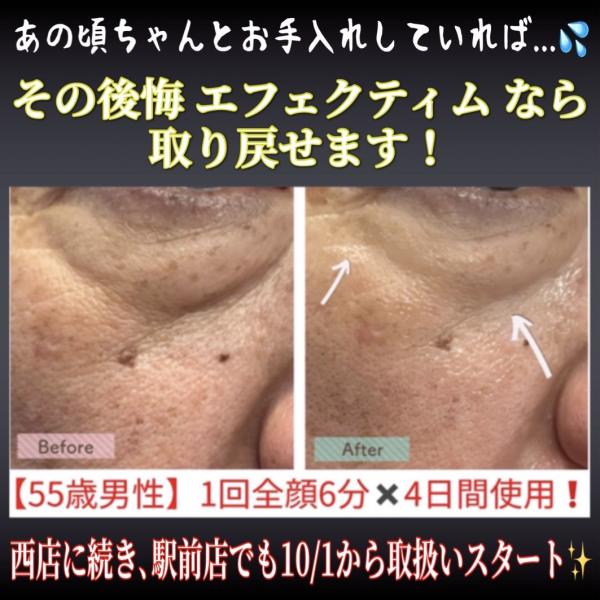 エフェクティム スムース ビューティー リフティング アクティベーター