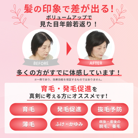 薬用ナノインパクト8レディ | ホソカワミクロン株式会社