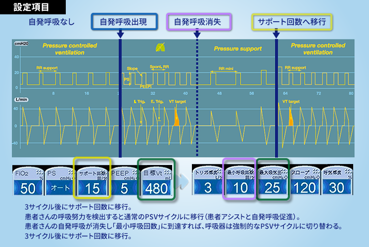 人工呼吸器 MONNAL T60 ベンチレータ 「新機能にズームイン！」｜医療