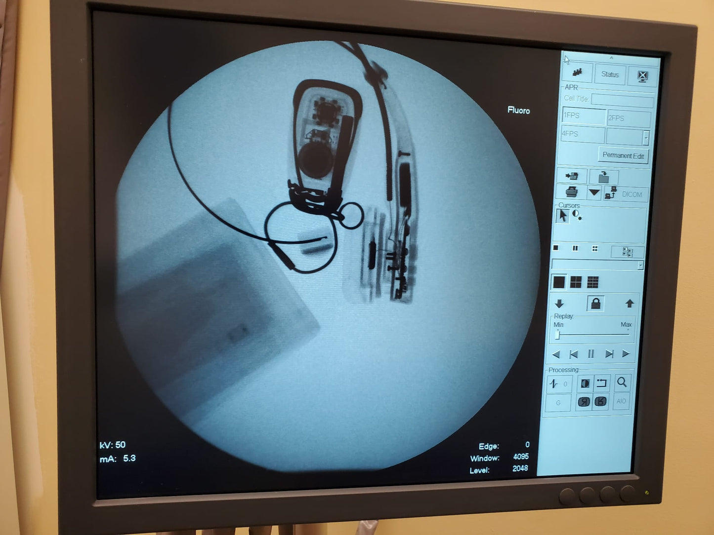 Shimadzu Sonialvision Versa 2015 WIT DAR-8000i, ZS-100IR