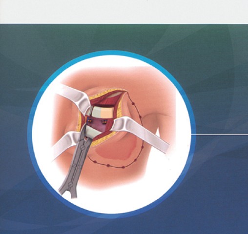 乳腺外科手術アトラス_立ち読み