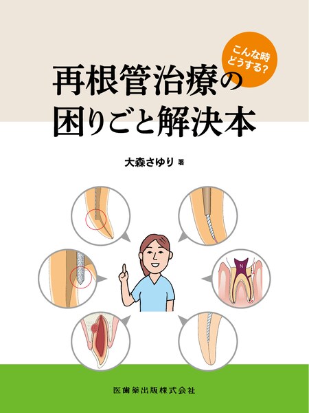歯内療法】の商品一覧／医歯薬出版株式会社