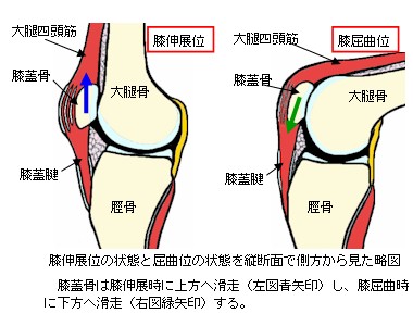 膝関節の構造と膝関節捻挫