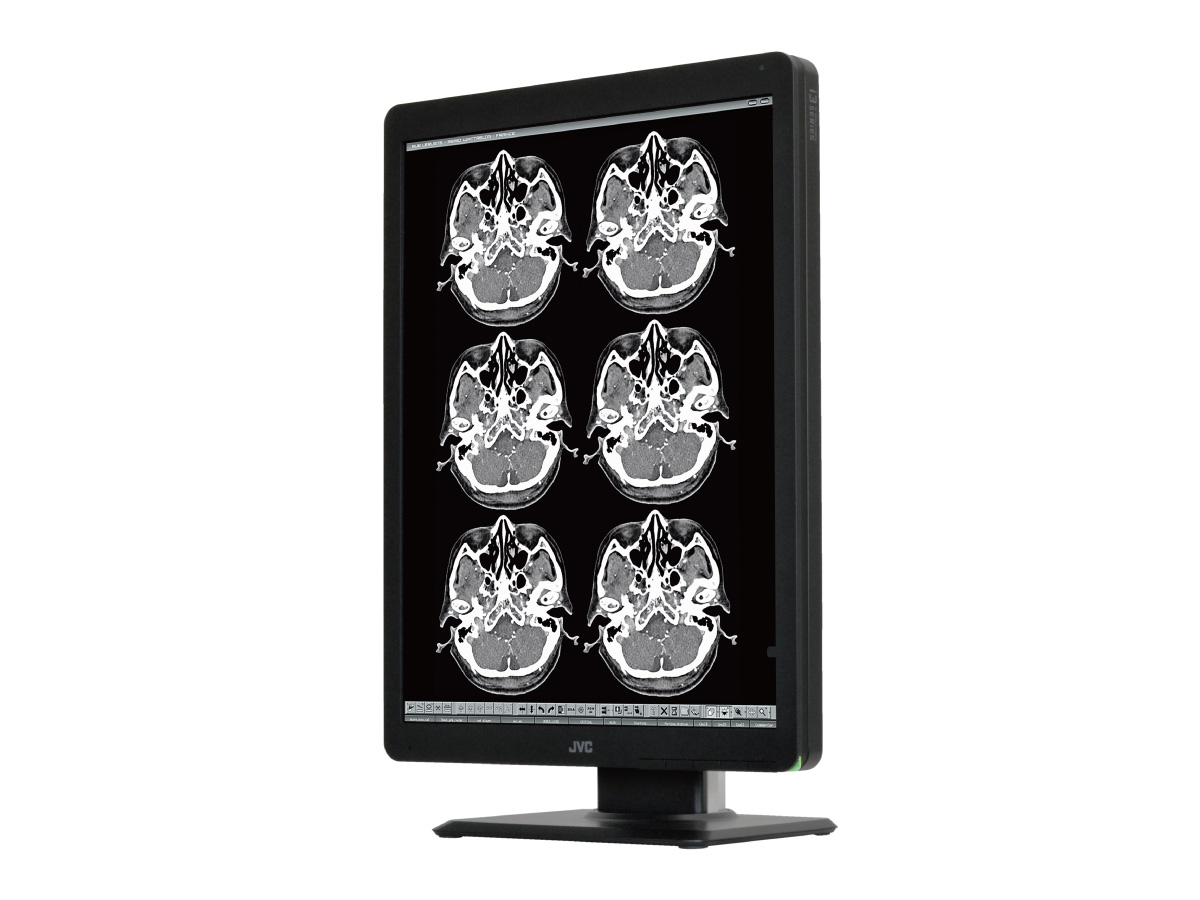 200万画素21.3型モノクローム液晶モニターMS-S200 | 医用モニター