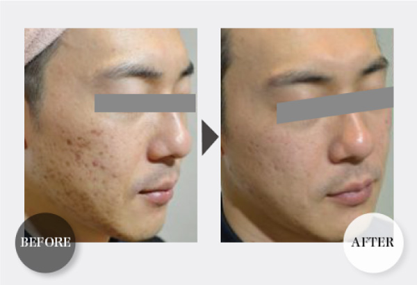 CRYSTAL PACK｜MONNALI - 株式会社モナリ