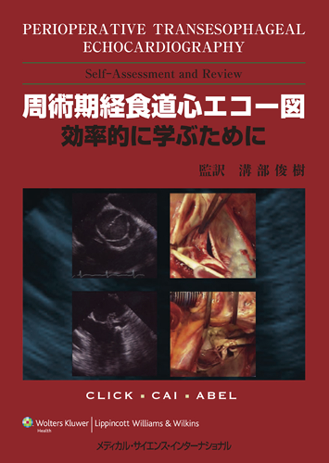 MEDSi)株式会社 メディカル・サイエンス・インターナショナル / 周術期