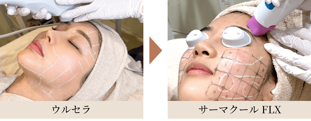 ウルセラ｜医療HIFUでたるみ治療 - 東京銀座の美容皮膚科【茉莉花